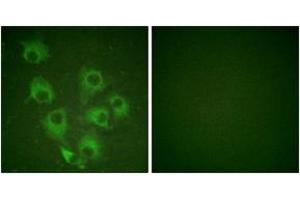 Immunofluorescence analysis of HuvEc cells, using CrkL (Phospho-Tyr207) Antibody. (CrkL anticorps  (pTyr207))