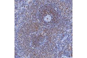 IHC analysis of TRMT61A using anti-TRMT61A antibody (ABIN7599220). (TRMT61A anticorps  (AA 1-289))