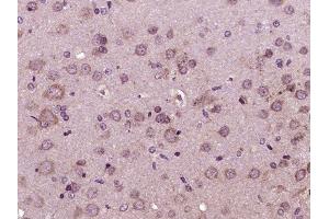 Paraformaldehyde-fixed, paraffin embedded rat brain tissue, Antigen retrieval by boiling in sodium citrate buffer (pH6.