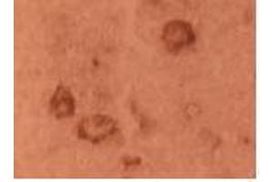 Immunohistochemistry (IHC) image for anti-F11 Receptor (F11R) antibody (ABIN1106263)