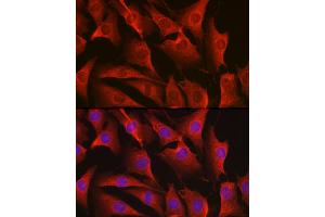 Immunofluorescence analysis of NIH-3T3 cells using ErbB4/HER4 Rabbit pAb (ABIN6131263, ABIN6140257, ABIN6140260 and ABIN6221732) at dilution of 1:100 (40x lens).