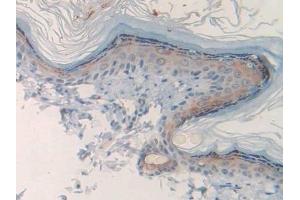 Detection of CHRM1 in Rat Skin Tissue using Polyclonal Antibody to Cholinergic Receptor, Muscarinic 1 (CHRM1)