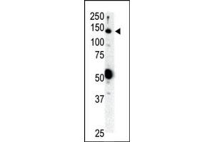 Image no. 1 for anti-Ret Proto-Oncogene (RET) (N-Term) antibody (ABIN359924) (Ret Proto-Oncogene anticorps  (N-Term))