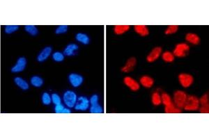 Immunofluorescence analysis of 293T cells using DiMethyl-Histone H3-K27 Polyclonal Antibody