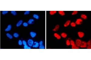 Immunofluorescence analysis of 293T cells using DiMethyl-Histone H3-K27 Polyclonal Antibody (Histone 3 anticorps  (2meLys27))