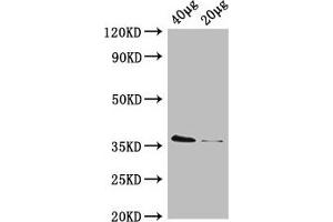 Western Blot Positive WB detected in: Rosseta bacteria lysate at 40 μg, 20 μg All lanes: dcyD antibody, HRP conjugated at 0. (DcyD anticorps  (AA 2-328) (HRP))