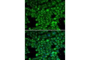 Immunofluorescence analysis of U2OS cells using LYZL6 antibody.