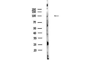 anti-Vacuolar Protein Sorting 11 Homolog (VPS11) (Internal Region) antibody