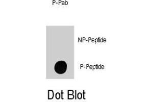Dot blot analysis of ILK (phospho T173) polyclonal antibody  on nitrocellulose membrane.
