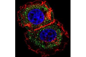 Fluorescent confocal image of MCF-7 cell stained with ESR1 isoform1 Antibody (C-term) (ABIN1881317 and ABIN2838677).