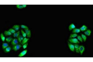 Immunofluorescent analysis of PC-3 cells using ABIN7146203 at dilution of 1:100 and Alexa Fluor 488-congugated AffiniPure Goat Anti-Rabbit IgG(H+L)