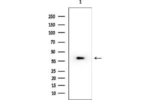 anti-Thymine-DNA Glycosylase (TDG) (Internal Region) antibody