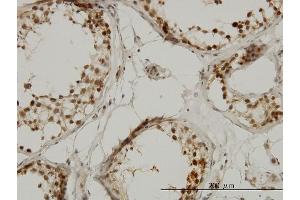 Immunoperoxidase of monoclonal antibody to TAF1L on formalin-fixed paraffin-embedded human testis.
