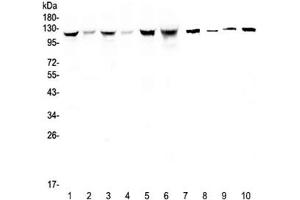 Western blot testing of human 1) HeLa, 2) placenta, 3) COLO-320, 4) HepG2, 5) SGC-7901, 6) Jurkat, 7) rat stomach, 8) mouse skeletal muscle, 9) mouse stomach and 10) mouse brain lysate with IDE antibody at 0.