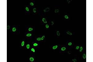 Immunofluorescent analysis of Hela cells using ABIN7139276 at dilution of 1:100 and Alexa Fluor 488-congugated AffiniPure Goat Anti-Rabbit IgG(H+L) (HIST1H3A anticorps  (H3K36me2))
