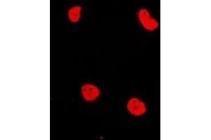 anti-RAD54-Like 2 (RAD54L2) antibody