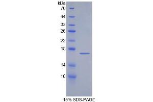 SDS-PAGE analysis of Human aZGP1 Protein. (AZGP1 Protéine)