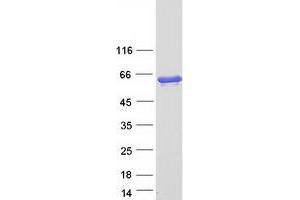 Validation with Western Blot