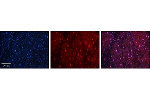 Rabbit Anti-HIPK2 Antibody    Formalin Fixed Paraffin Embedded Tissue: Human Adult heart  Observed Staining: Nuclear Primary Antibody Concentration: 1:600 Secondary Antibody: Donkey anti-Rabbit-Cy2/3 Secondary Antibody Concentration: 1:200 Magnification: 20X Exposure Time: 0. (HIPK2 anticorps  (Middle Region))