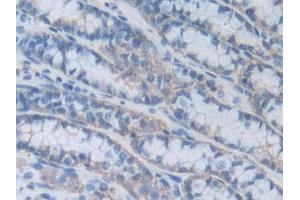 IHC-P analysis of Mouse Small intestine Tissue, with DAB staining. (HPSE anticorps  (AA 353-464))