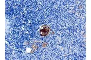 Formalin-fixed, paraffin-embedded human Spleen stained with TRAcP Monoclonal Antibody (SPM601).