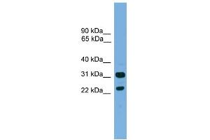 WB Suggested Anti-CD8B Antibody Titration:  0. (CD8B anticorps  (Middle Region))