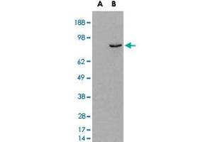 HEK293 overexpressing human PDE4B and probed with PDE4B polyclonal antibody  (mock transfection in first lane), tested by Origene. (PDE4B anticorps)
