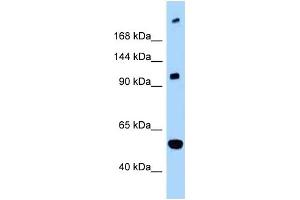 WB Suggested Anti-L1CAM Antibody Titration: 1. (L1CAM anticorps  (C-Term))