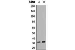 Western blot analysis of ACER2 expression in A549. (ACER2 anticorps  (Center))