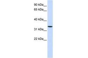 Image no. 1 for anti-Wingless-Type MMTV Integration Site Family, Member 6 (WNT6) (AA 252-301) antibody (ABIN6740986)