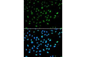 Immunofluorescence analysis of A549 cells using SMARCA4 antibody (ABIN5971144).