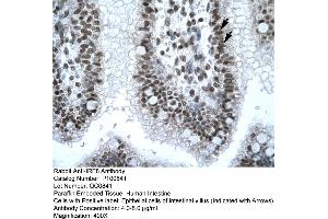Immunohistochemistry with Human Intestine tissue
