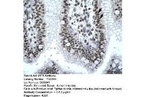 Immunohistochemistry with Human Intestine tissue (IRF8 anticorps  (N-Term))