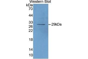 Western Blotting (WB) image for anti-Interleukin 2 Receptor, alpha (IL2RA) (AA 22-243) antibody (ABIN1862763) (CD25 anticorps  (AA 22-243))