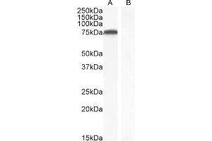 ABIN184605 (1ug/ml) staining of Jurkat nuclear cell lysate (A) and negative control Human parathyroid gland (B) (35µg protein in RIPA buffer).
