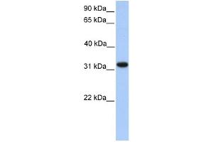 WB Suggested Anti-ETFA Antibody Titration: 0. (ETFA anticorps  (N-Term))