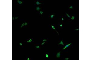 Immunofluorescence staining of SH-SY5Y cells with ABIN7161274 at 1:100, counter-stained with DAPI.