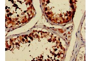 Immunohistochemistry of paraffin-embedded human testis tissue using ABIN7173663 at dilution of 1:100