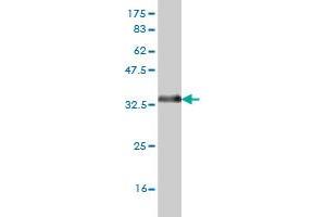 Western Blot detection against Immunogen (33. (ZIC4 anticorps  (AA 249-319))