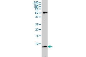 ATP5E monoclonal antibody (M01), clone 2F3 Western Blot analysis of ATP5E expression in SW-13 .