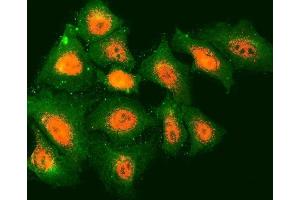 IF analysis of TMOD2 and Tubulin beta using anti-TMOD2 antibody (ABIN7599739) and anti-Tubulin beta antibody (ABIN7602744). (TMOD2 anticorps  (AA 111-343))