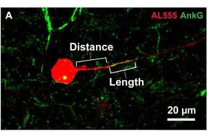 Representative image of Alexa 555 (AL555, red) dye-filled RGC labeled for the axon initial segment (AIS) scaffolding protein ankyrin-G (AnkG, cat. (Ankyrin G anticorps)
