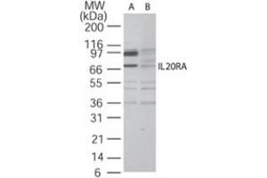 Western blot analysis of IL20RA in A-375 cell lysate in the (A) absence and (B) presence of blocking peptide using IL20RA polyclonal antibody  at 2 ug/mL .