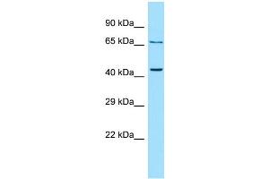 WB Suggested Anti-PTH2R Antibody Titration: 1. (PTH2R anticorps  (C-Term))