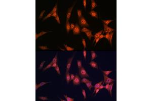 Immunofluorescence analysis of NIH/3T3 cells using P antibody (ABIN7269146) at dilution of 1:100. (PAK2 anticorps)
