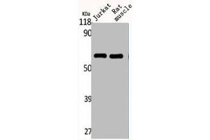 Western Blot analysis of Jurkat RAT-MUSCLE cells using CYP4Z1/2 Polyclonal Antibody (CYP4Z2P anticorps  (Internal Region))