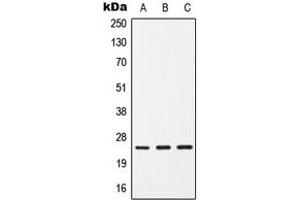 Western blot analysis of CD9 expression in HepG2 (A), SP2/0 (B), H9C2 (C) whole cell lysates. (CD9 anticorps  (Center))
