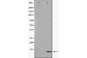Western blot analysis of extracts of mouse kidney, using CYCS antibody.
