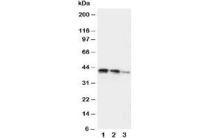 Western blot testing of DDR2 antibody and Lane 1:  recombinant human protein 10ng;  2: 5ng;  3: 2. (DDR2 anticorps  (C-Term))