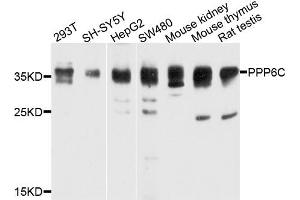 Western blot analysis of extracts of various cells, using PPP6C antibody. (PPP6C anticorps)